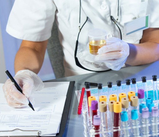 Urine Analysis Urine Analysis